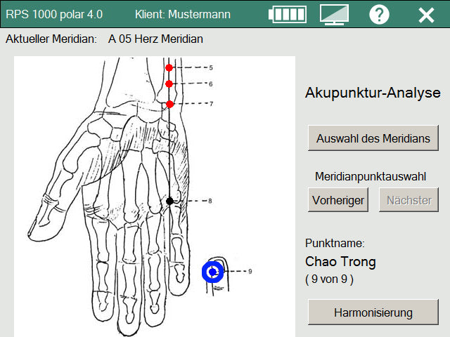 Rayoscan Software Upgrade for Acupuncture Analysis in Polar 4.0
